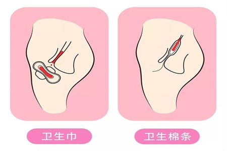 处女膜